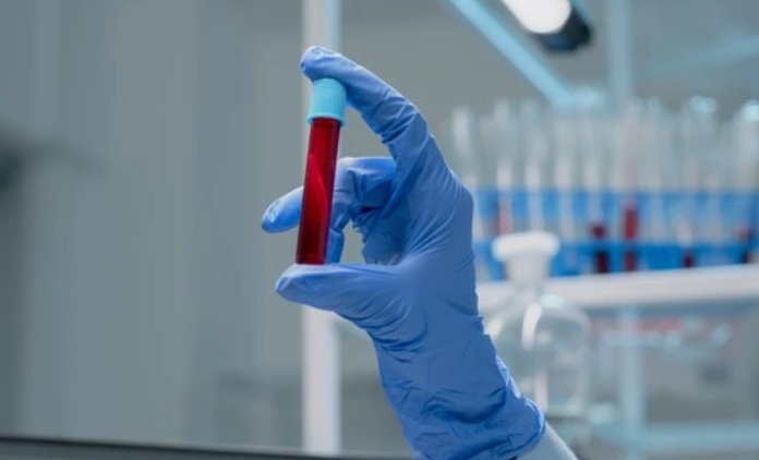 Anticorpos, também chamados de imunoglobulinas (Ig), são glicoproteínas produzidas por plasmócitos. As imunoglobulinas são formadas por uma combinação