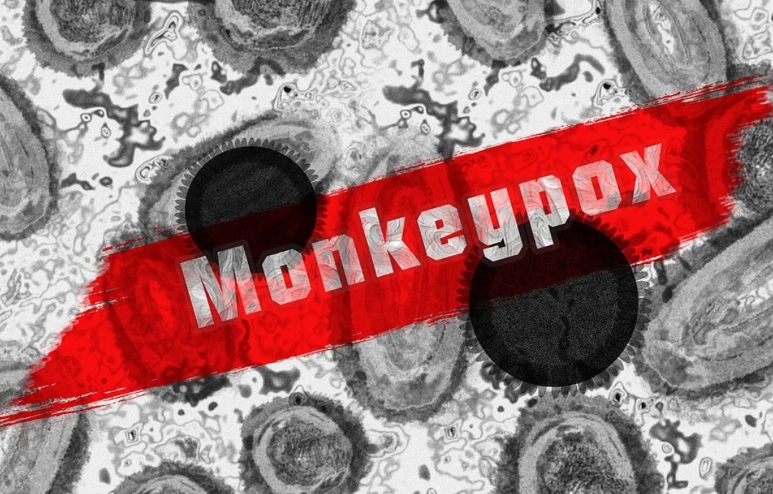 Um surto de varíola dos macacos foi confirmado em 6 de maio de 2022 no Reino Unido, começando em um residente britânico que viajou para a Nigéria.